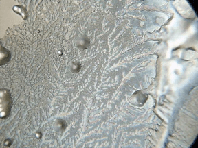 Wat doet straling in je lichaam