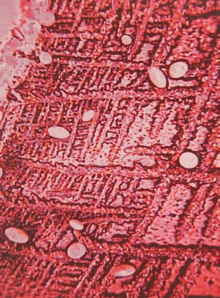 Wat doet straling in je lichaam